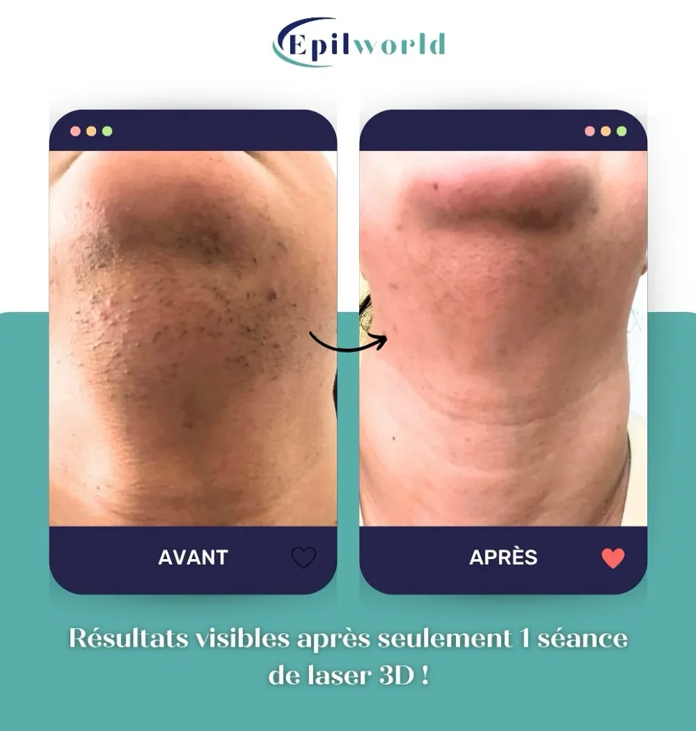 imgi_60_463345637_17887874712100365_7293770511307956458_n